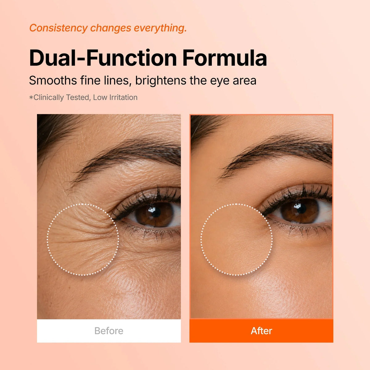 🎁360° PDRN &amp; Peptide Full-Coverage Eye Mask Patches