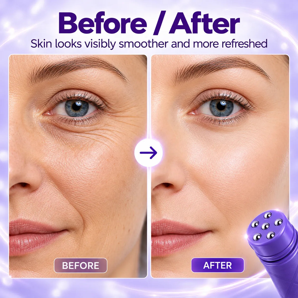 🎁Multi-Peptide Wrinkle Roller Cream – Cooling Eye & Neck Care